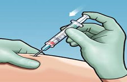 Botox injection for spasticity 